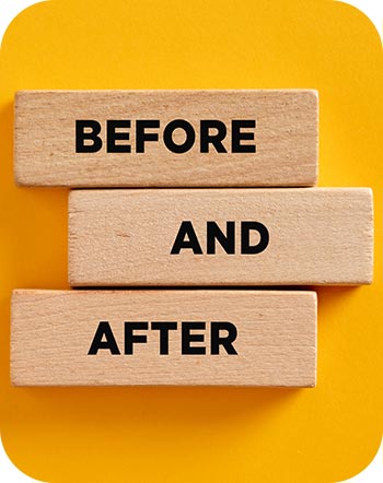Before and After at Vermont Medspa in Los Angeles, CA