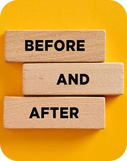 Before and After at Vermont Medspa in Los Angeles, CA