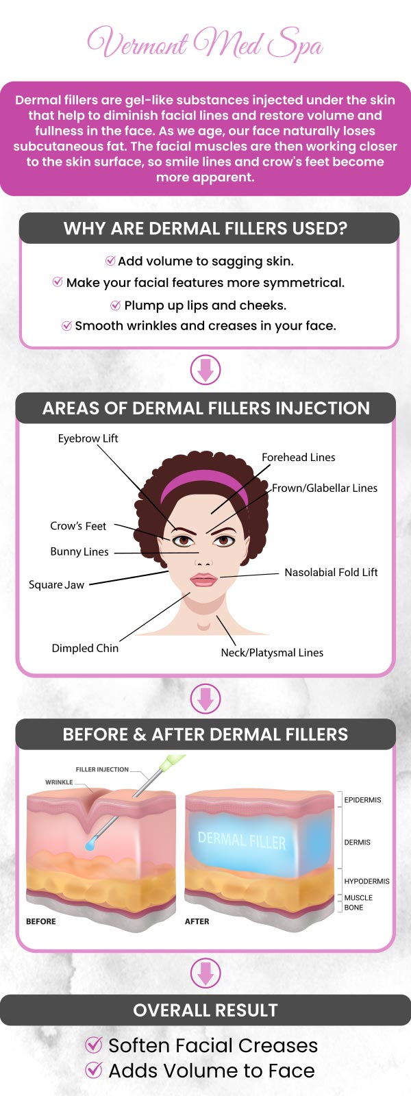Dermal Fillers at Vermont Med Spa, led by Dr. Imad El Asmar, are designed to enhance facial volume, smooth wrinkles, and improve contours. With advanced techniques and high-quality products, we offer personalized treatments for natural looking results. For more information, contact us or request an appointment online. We are conveniently located at 1234 N. Vermont Avenue Los Angeles, CA 90029. Dermal Fillers at Vermont Med Spa, led by Dr. Imad El Asmar, are designed to enhance facial volume, smooth wrinkles, and improve contours. With advanced techniques and high-quality products, we offer personalized treatments for natural looking results. For more information, contact us or request an appointment online. We are conveniently located at 1234 N. Vermont Avenue Los Angeles, CA 90029.