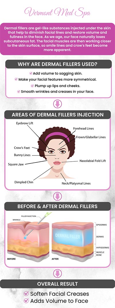 Dermal Fillers at Vermont Med Spa, led by Dr. Imad El Asmar, are designed to enhance facial volume, smooth wrinkles, and improve contours. With advanced techniques and high-quality products, we offer personalized treatments for natural looking results. For more information, contact us or request an appointment online. We are conveniently located at 1234 N. Vermont Avenue Los Angeles, CA 90029. Dermal Fillers at Vermont Med Spa, led by Dr. Imad El Asmar, are designed to enhance facial volume, smooth wrinkles, and improve contours. With advanced techniques and high-quality products, we offer personalized treatments for natural looking results. For more information, contact us or request an appointment online. We are conveniently located at 1234 N. Vermont Avenue Los Angeles, CA 90029.