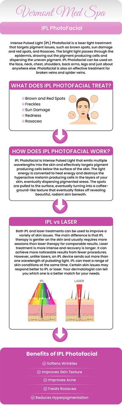 Achieve radiant, even-toned skin with Lumecca IPL treatments at Vermont Med Spa, led by Dr. Imad El Asmar. This advanced Intense Pulsed Light therapy targets pigmentation issues, sun damage, and vascular lesions, delivering exceptional results with minimal downtime. Experience personalized care and transformative outcomes at Vermont Med Spa. For more information, contact us or request an appointment online. We are conveniently located at 1234 N. Vermont Avenue Los Angeles, CA 90029.