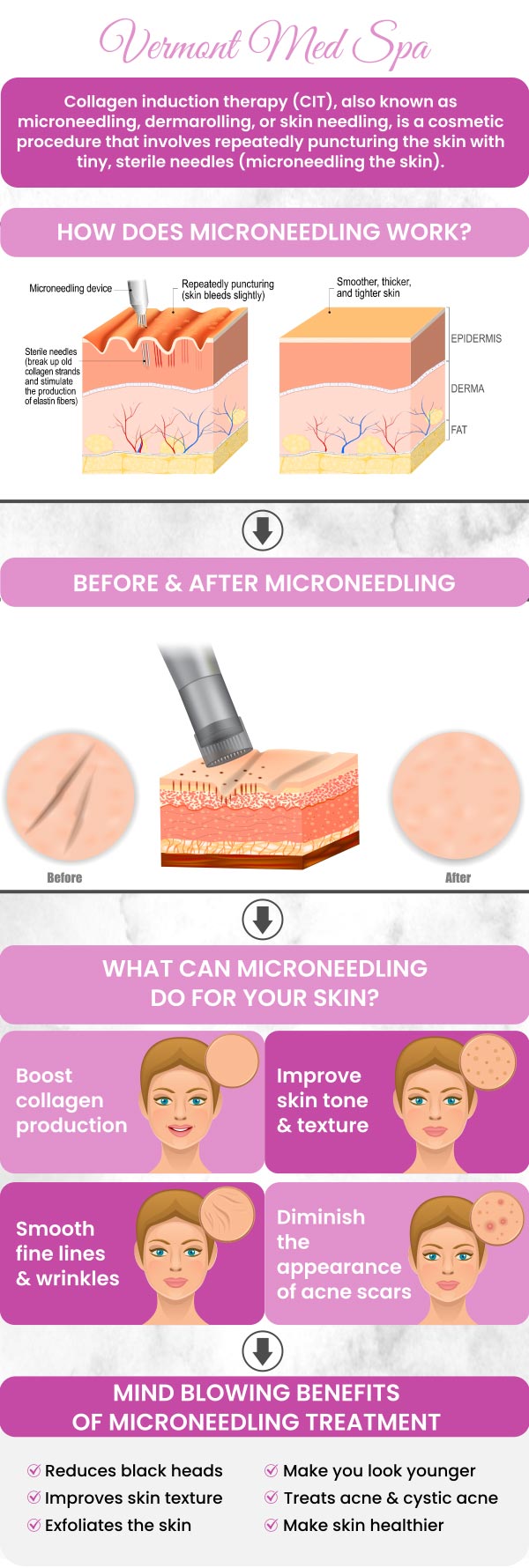 At Vermont Med Spa, led by Dr. Imad El Asmar, microneedling is a cornerstone treatment for skin rejuvenation. This minimally invasive procedure utilizes fine needles to create controlled micro-injuries in the skin, stimulating collagen and elastin production. It's effective for addressing concerns such as fine lines, acne scars, enlarged pores, and uneven skin texture. For more information, contact us or request an appointment online. We are conveniently located at 1234 N. Vermont Avenue Los Angeles, CA 90029.