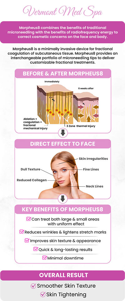 At Vermont Med Spa, led by Dr. Imad El Asmar, Morpheus8 is a cutting edge treatment that combines microneedling with radiofrequency energy to stimulate collagen production, tighten skin, and reduce fat. This minimally invasive procedure is effective for addressing concerns such as fine lines, wrinkles, acne scars, and sagging skin on both the face and body. For more information, contact us or request an appointment online. We are conveniently located at 1234 N. Vermont Avenue Los Angeles, CA 90029. At Vermont Med Spa, led by Dr. Imad El Asmar, Morpheus8 is a cutting edge treatment that combines microneedling with radiofrequency energy to stimulate collagen production, tighten skin, and reduce fat. This minimally invasive procedure is effective for addressing concerns such as fine lines, wrinkles, acne scars, and sagging skin on both the face and body. For more information, contact us or request an appointment online. We are conveniently located at 1234 N. Vermont Avenue Los Angeles, CA 90029.