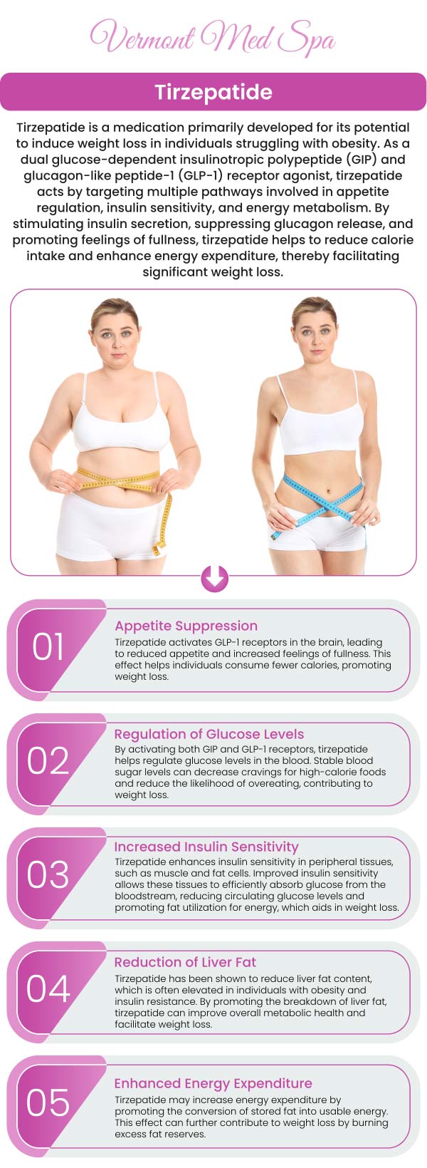 Tirzepatide for Medical Weight Loss in Los Angeles, CA