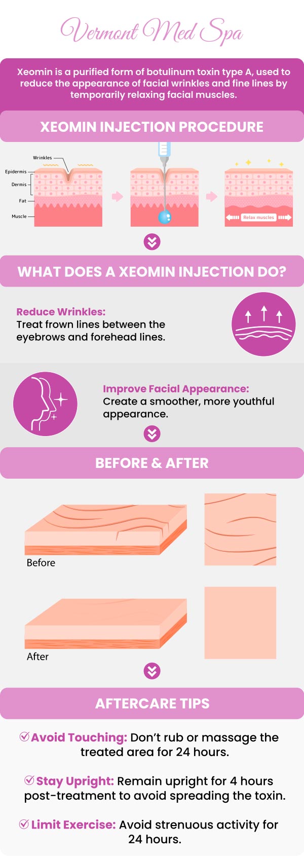 At Vermont Med Spa, Dr. Imad El Asmar offers Xeomin injections to smooth moderate to severe frown lines between the eyebrows. This FDA-approved neurotoxin provides a refreshed appearance with minimal downtime. With a focus on personalized care. Experience professional and effective results in a comfortable setting. For more information, contact us or request an appointment online. We are conveniently located at 1234 N. Vermont Avenue, Los Angeles, CA 90029. At Vermont Med Spa, Dr. Imad El Asmar offers Xeomin injections to smooth moderate to severe frown lines between the eyebrows. This FDA-approved neurotoxin provides a refreshed appearance with minimal downtime. With a focus on personalized care. Experience professional and effective results in a comfortable setting. For more information, contact us or request an appointment online. We are conveniently located at 1234 N. Vermont Avenue, Los Angeles, CA 90029.
