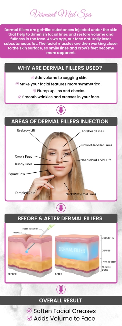 If you are looking for a filler specialist in Los Angeles, CA, Dr. Imad El Asmar, offers personalized treatments designed to enhance your natural features. We focus on soft, balanced results for marionette lines, lips, cheeks, jawline, and other areas where volume loss can affect your appearance. Patients choose Vermont Med Spa for customized filler plans, careful facial assessment, and a refreshed look that does not appear overdone. For more information, contact us or request an appointment online. We are conveniently located at 1234 N. Vermont Avenue Los Angeles, CA 90029. If you are looking for a filler specialist in Los Angeles, CA, Dr. Imad El Asmar, offers personalized treatments designed to enhance your natural features. We focus on soft, balanced results for marionette lines, lips, cheeks, jawline, and other areas where volume loss can affect your appearance. Patients choose Vermont Med Spa for customized filler plans, careful facial assessment, and a refreshed look that does not appear overdone. For more information, contact us or request an appointment online. We are conveniently located at 1234 N. Vermont Avenue Los Angeles, CA 90029.